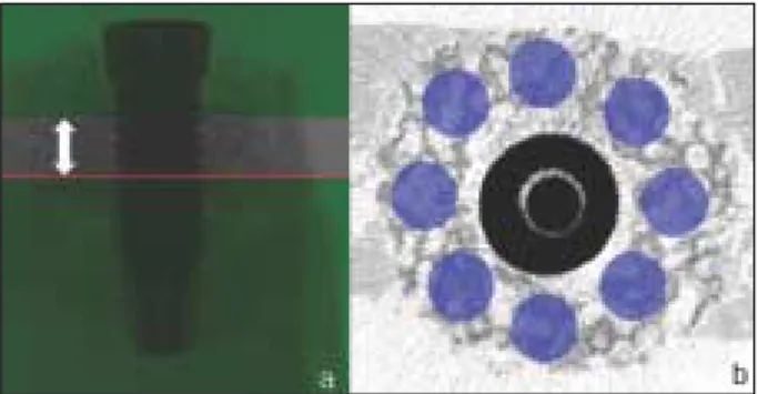 Fig. 3. Micro-CT images; ROI for BIC measurement. a) The location of sectioning, b) In two rectangular areas, BIC was evaluated