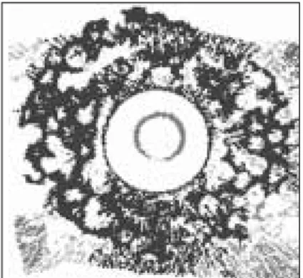 Fig. 6. The processed image: Implant portion was removed by threshold adjustment to investigate the ring shape metal artifacts around titanium implant more easily.