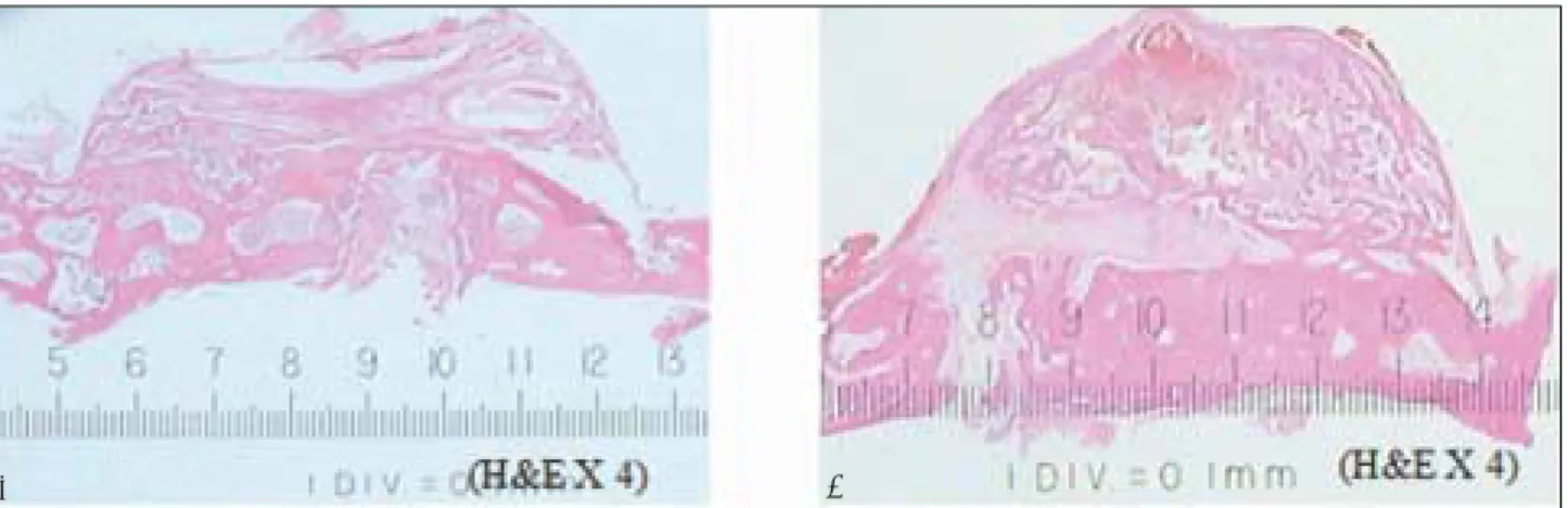 Fig. 6-a, b. The control group at 3 week(a), 6 week(b) showed that new bone was generated through the penetrated marrow spaces of the skull under the cap