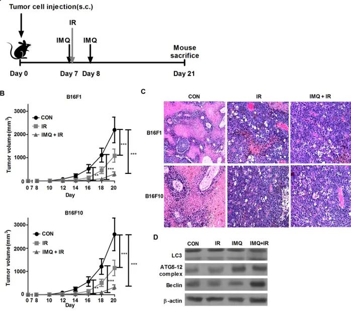 Figure 3: IMQ radiosensitizes melanoma in an in vivo mouse model.  A. Experimental schedule of tumor cell injection, IMQ  treatment and IR exposure