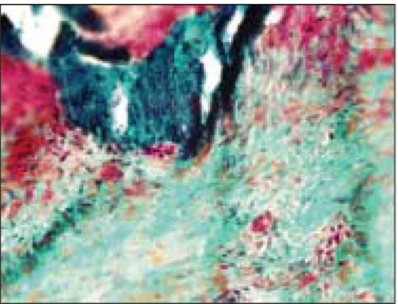 Fig. 10. Histologic views of 8 weeks group(x40).