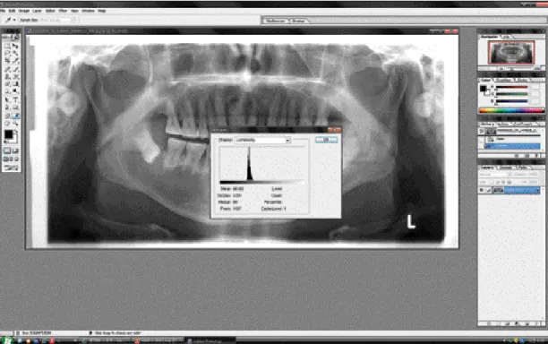 Fig. 1. 255 tonalities, Gray-level histogram