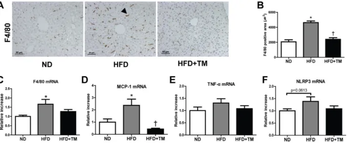 Figure 3: Early TM5441  treatment  suppressed  hepatic  inflammation  in  HFD  mice.  (A,  B) Anti-inflammatory  effect  of  TM5441 was analyzed through quantifying positive F4/80 IHC staining area in the liver section