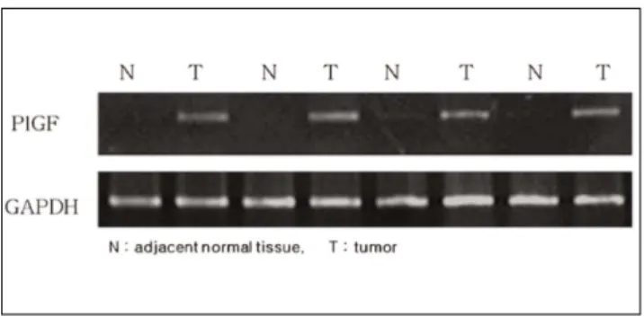 Table 2. The Correlation between Immunohistopathological PlGF Expression and Clinical and Pathological Factors