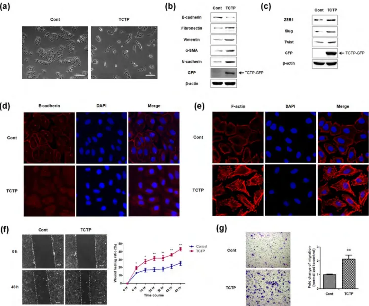 Figure 1 | Ectopic overexpression of TCTP promotes EMT and enhances cell migration. (a) Phase-contrast microscopic images of LLC-PK1 cells infected with control Ad-GFP virus (Cont) or Ad-TCTP-GFP virus (TCTP)