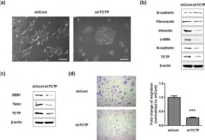 Figure 2 | Knockdown of TCTP reverses EMT phenotypes and suppresses cell migration. (a) Phase-contrast microscopic images of LLC-PK1 cells transfected with control shRNA (shCont) or TCTP shRNA (shTCTP)