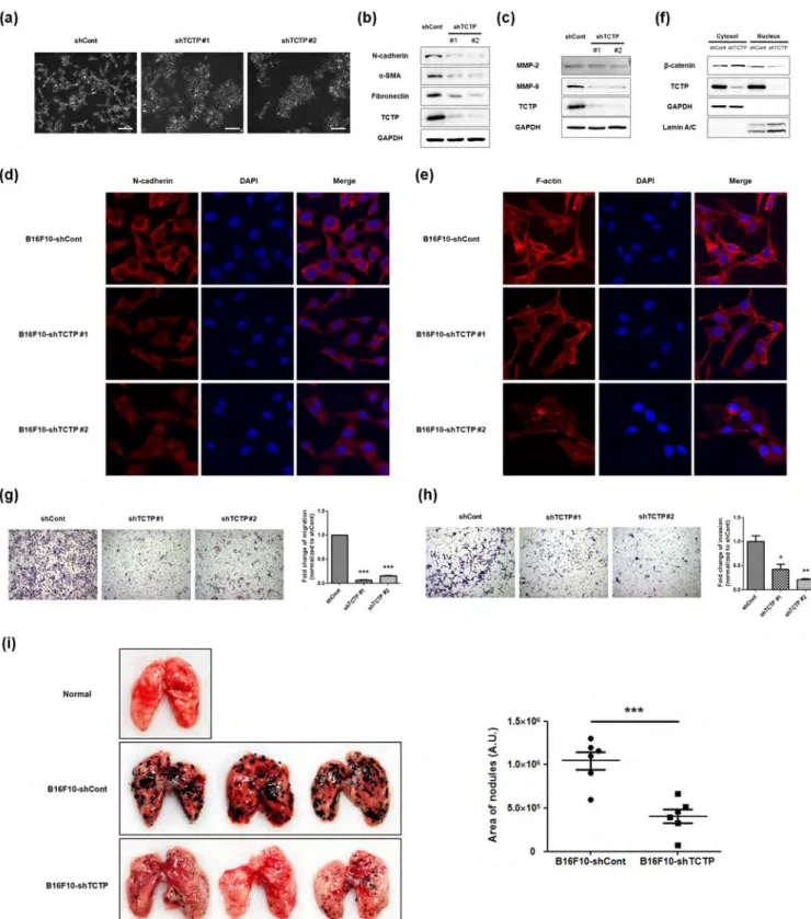 Figure 5 | Silencing TCTP promotes MET process and suppresses pulmonary metastasis of mouse melanoma cell line