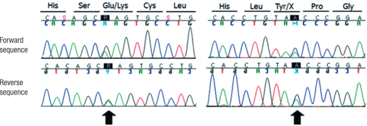 Fig. 2. Direct sequencing of the INSR gene in our patient. Compound heterozygous for two mutations were identified: c.90C>A (p.Tyr30X) in exon 1 and c.712G>A (p.Glu238Lys)  in exon 3 (arrows).