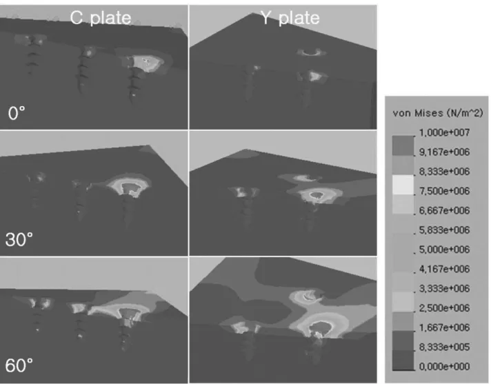 Fig. 3. Von Mises stress distributions of the cortical and cancellous bone in C plate and Y plate models.