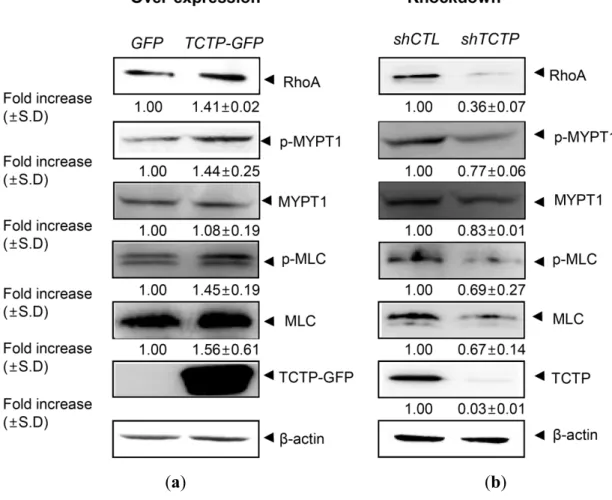 Figure 1. Role of  translationally controlled tumor protein ( TCTP) in the RhoA-mediated  signaling pathway in  vascular smooth muscle cells ( VSMCs)