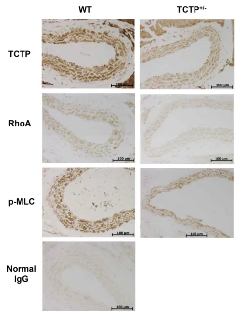 Figure 3. Role of TCTP in the RhoA-mediated signaling pathway in TCTP +/−  mice.  Representative photomicrographs indicating immunoreactivity of TCTP, RhoA, and p-MLC  in the sections of aortic tissues from WT and TCTP +/−  mice