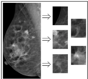 Fig. 1 Lesion Detection algorithm 