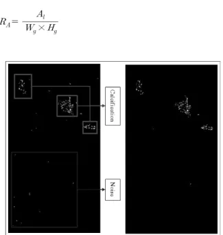 Fig. 3 Noise eliminated process Fig. 4 Feature extraction process   ≥   or  and ≥   (3)식 (1)의 와 는 영역의 가로, 세로의 크기를 와 는 영역의 시작 좌표이며,  는  좌표의 명암 값을 나타내고 식 (3)의 식의  는 전체영역의 평균과 표준편차이다.병변은 주변 명암 값과 차이가 있으