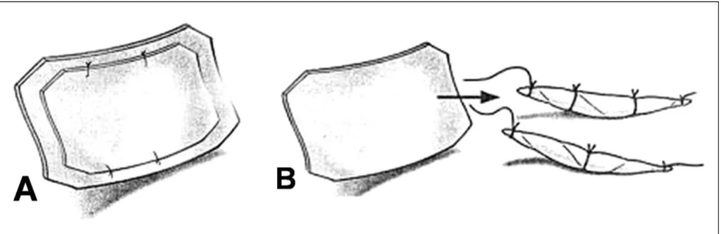 Fig. 2.  The volume change after the autogenous dermis and the AlloDerm � graft according to the time elapsed.