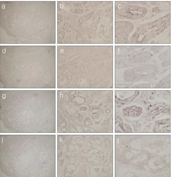 Fig. 3. Histologic features of in situ hybridization of adenoid cystic carcinoma.