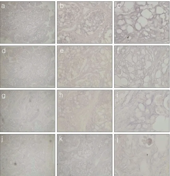Fig. 4. Histologic features of in situ hybridization of mucoepidermoid carcinoma.