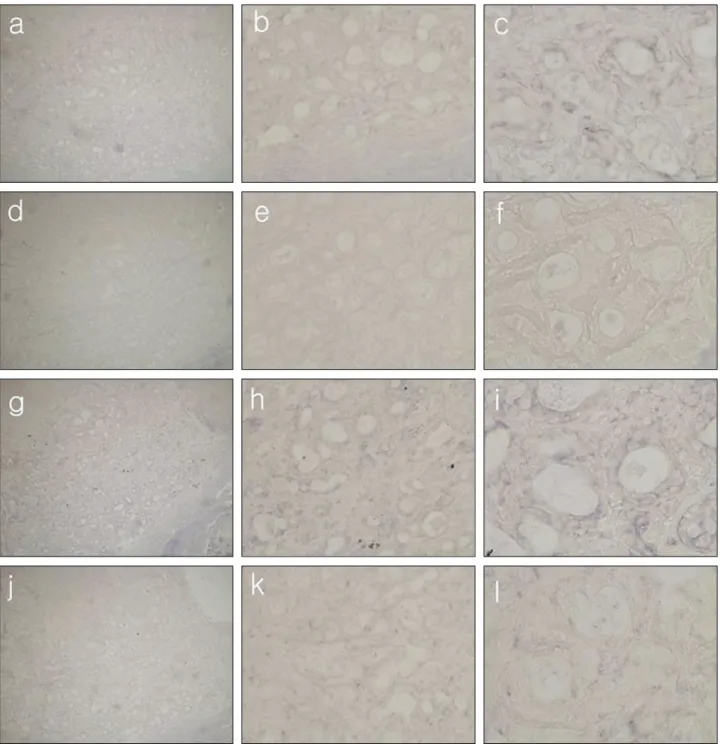 Fig. 5. Histologic features of in situ hybridization of pleomorphic adenoma.