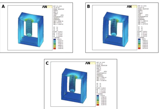 Fig. 3. The stress contour of the cortical bone according to loading point of the 4mm diameter and 12mm height triangular implants.