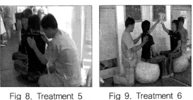 Fig  8.  Treatment  5  Fig  9.  Treatment  6 