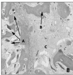 Fig. 3.  A. Bone formation at the distracted area in the control group (arrow indicates the distracted length).