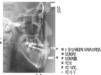 Fig. 1. Reference plane &amp; Measuring items.