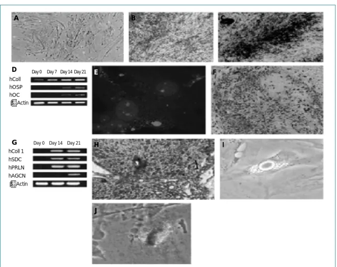 그림 4. 제대혈에서 간엽줄기세포를 분리하여 체외 배양하면서 골아세포, 연골세포, 지방세포로의 분화 유도EFIHJDhCollhOSPhOCβ－Actin