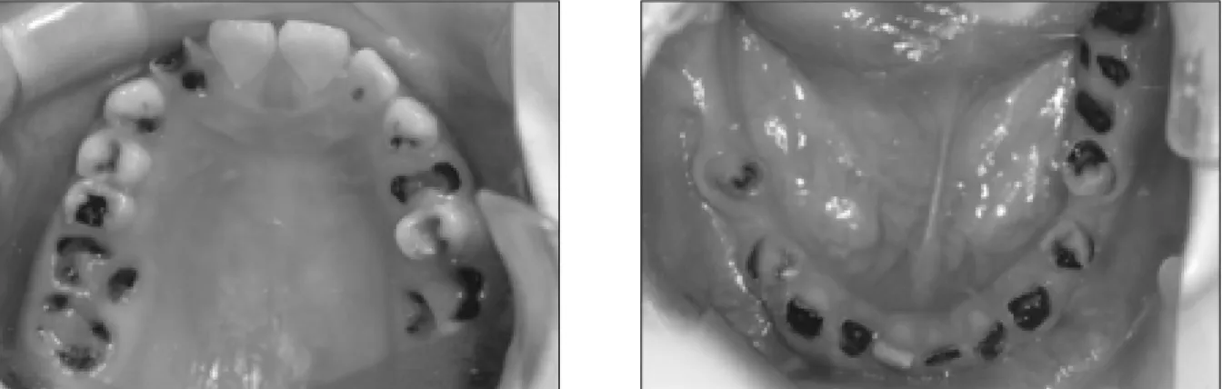 Fig. 2. Intra-oral  photography at the initial examination.