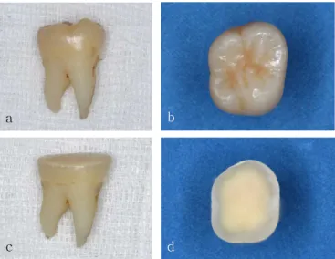 Figure  1.  Preparation  of  tooth a,  b:  before  the  preparation  of  tooth