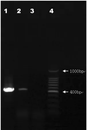 Fig. 2. Analysis of ITS PCR. Lane 1, dematiaceous fun-