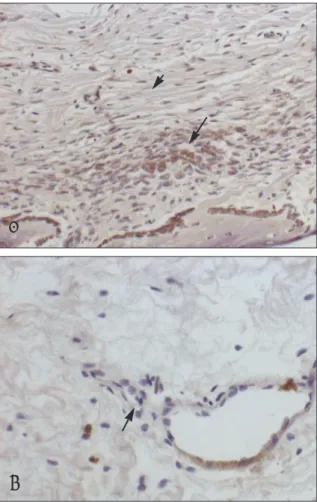 Fig. 3. Expression of Flt-1 in the distracted periosteum.