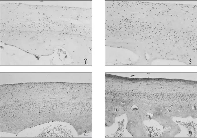 Fig. 10. Representative photomicrographs of staining for tissue inhibitor of matrix metlloproteinase-2 (TIMP-2) in experi- experi-mental condyles (7 days (A), 14 days (B), 28 days (C), and 56 days (D)) after completion of distraction.