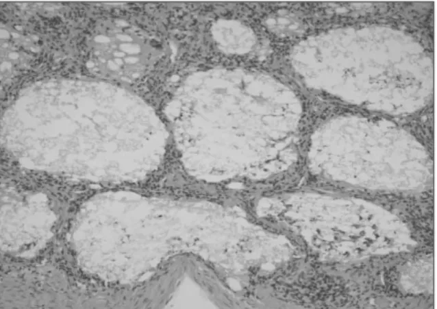 Fig. 10. Microscopic  exam.  shows  the  β-TCP  with  PRP graft. 4 weeks (× 200, H&amp;E).