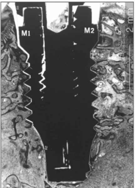 Fig. 1. Histologic micrograph of the ground section.