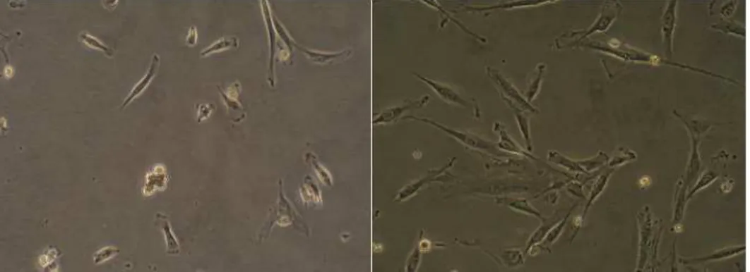 Fig. 1. Characteristic feature of human mesenchymal stem cells treated with basic fibroblast growth factor