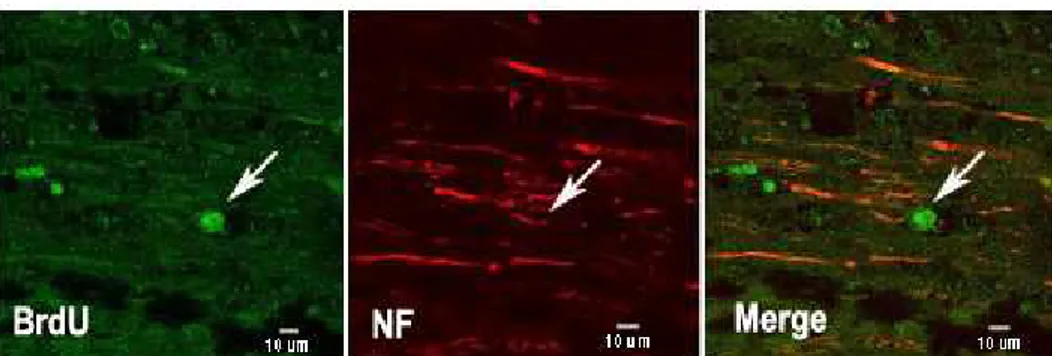 Fig. 8. Confocal image of double-color immunohistochemical staining for BrdU 1 and NF 2 in human mesenchymal stem cells transplantation group with basic fibroblast growth factor infusion into CSF