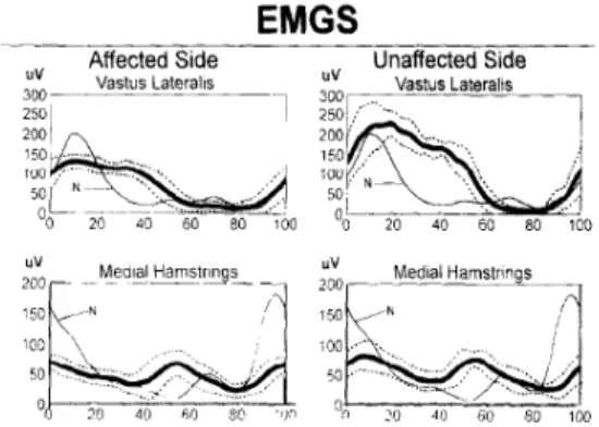 그림 6. Mean  and  standard  deviation  of  EMGs                      showing  co-activation  hamstrings  and                        knee extensors sustained into stance phase