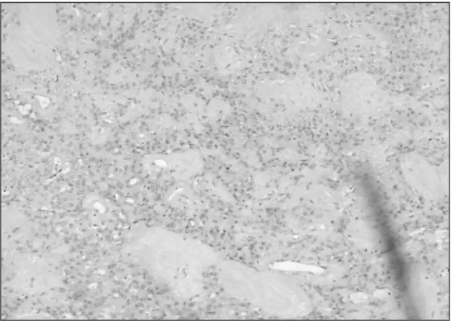 Fig. 9. Microphotograph of the permanent biopsy show- show-ing many clusters of the epithelial cells and the myxoid stroma,  which  diagnosed  histopathologically  as   pleo-morphic adenoma (Hematoxyline-Eosin stain, ×30).