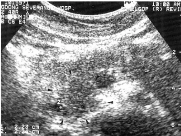 Fig. 1. An abdominal ultrasonographic finding on admis-