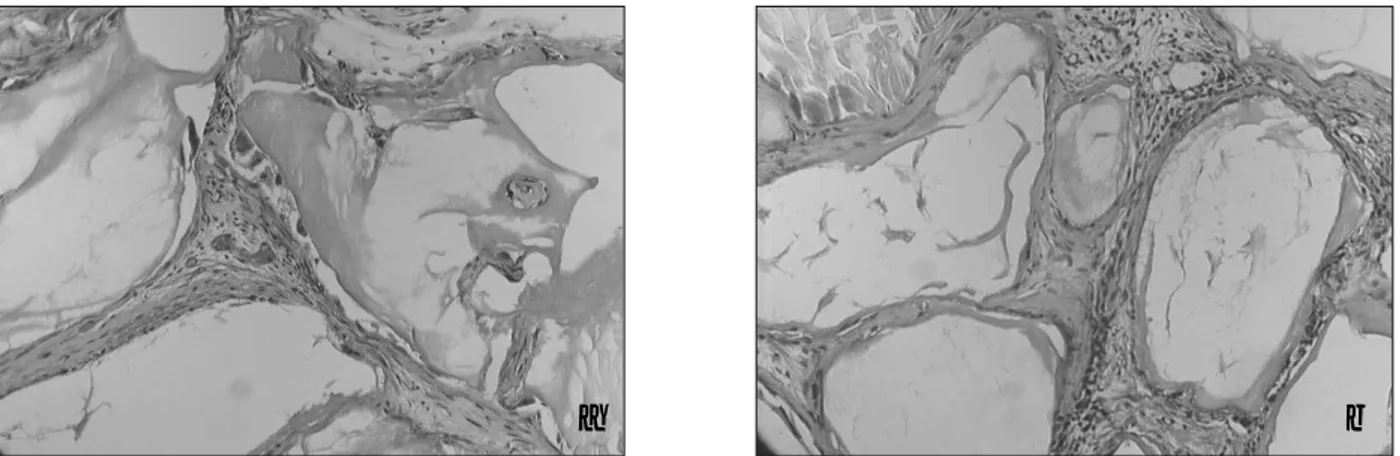 Fig. 9. Histologic finding of hMSC-derived osteogenesis with HA/TCP as matrix.