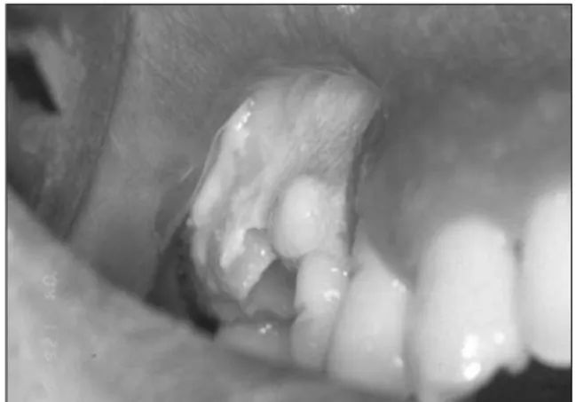 Fig. 5. Post-operative state (After healing). 