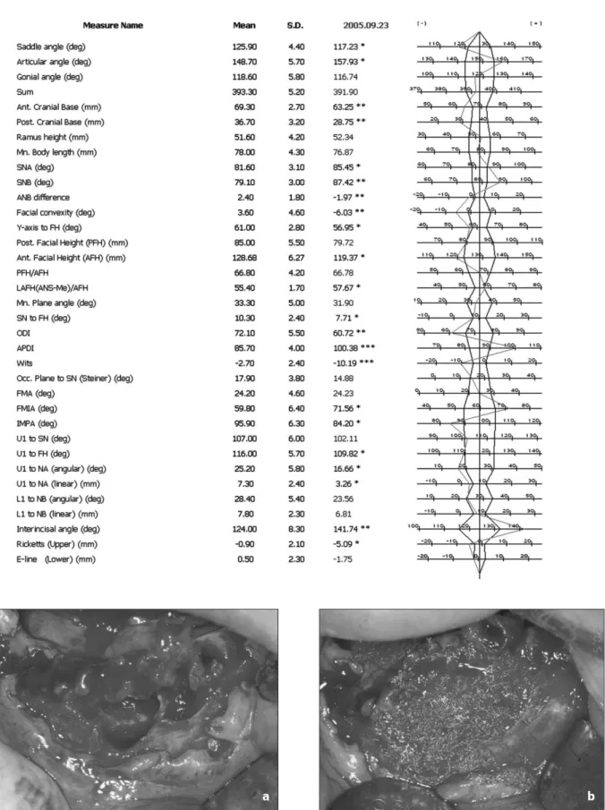 Fig. 5. a. After extraction of #44, 83, 41, 31, 32, b. Hydroxyapatite graft was done.