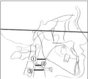 Fig. 4. Two dimensional position of Hyoid bone.