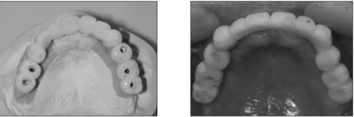 Fig. 11. Periapical initial radiograph.