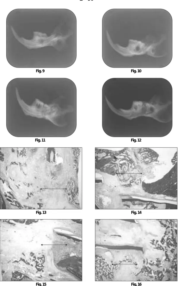 Fig. 9 Fig. 10