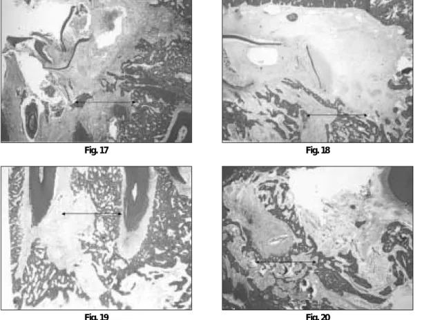 Fig. 17 Fig. 18