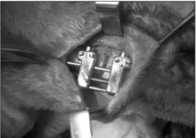 Fig. 1. Mandibular  distractor  placed  through  a  sub- sub-mandibular approach.