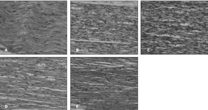 Fig. 3. Microscopic view of inferior alveolar nerve after Hematoxyline-eosin staining (Control (A), 7 days (B), 14 days (C), 28 days (D) and 56 days (E) after completion of distraction, original magnification, × 200).