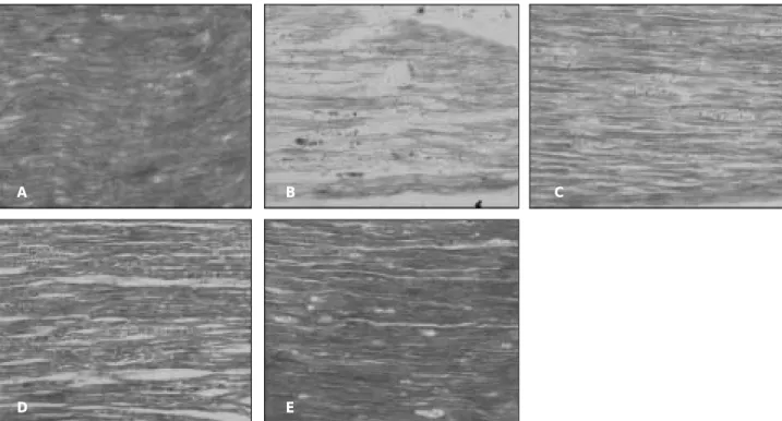Fig. 4. Microscopic view of inferior alveolar nerve after Luxol Fast Blue staining (Control (A), 7 days (B), 14 days (C), 28 days (D) and 56 days (E) after completion of distraction, original magnification, × 200).
