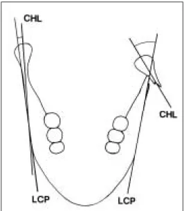 Fig. 1.  Reference Points and Lines on Panorama  Fig. 2.  Reference Lines on Modified Towne’ s view