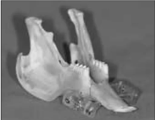 Fig. 5. Extraoral photographs.